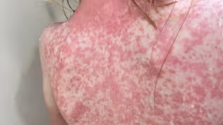 En 96 días del año, la incidencia de contagios es de 1.57 detectados diariamente