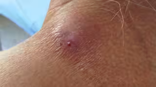 Sector rural en alerta por plaga y sequías en Los Chenes