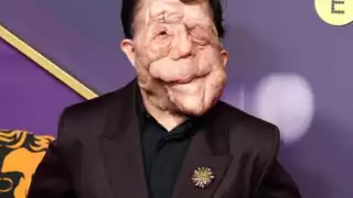 Adam Pearson asistió a los BAFTA por su papel en 'A Different Man'