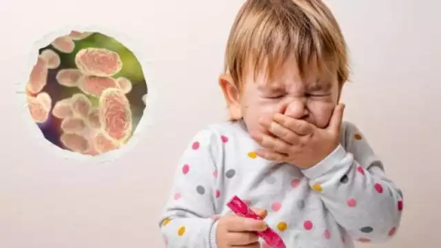 Brote de tos ferina: Secretos de una infección altamente contagiosa