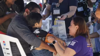 Abren registro en Mérida para las jornadas gratuitas de cirugía para personas con labio y paladar hendido