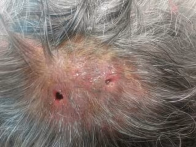 SSA alerta: adultos mayores en abandono, los más vulnerables al gusano barrenador en Campeche