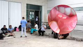 Casos de sífilis en Q. Roo: Detectan más de  400 contagios en lo que va del 2025 