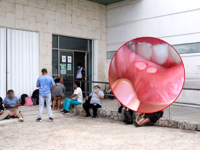 De enero a septiembre del año pasado se contabilizaron 324 diagnósticos, lo que significa que hubo 100 menos, lo que alertó a autoridades sanitarias