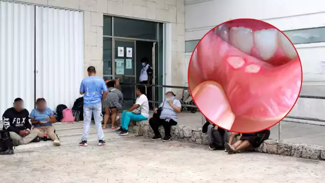 De enero a septiembre del año pasado se contabilizaron 324 diagnósticos, lo que significa que hubo 100 menos, lo que alertó a autoridades sanitarias