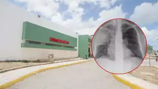 Incrementa 111% la neumonía en Q. Roo: Registran 19 casos en la semana 40 de la SINAVE