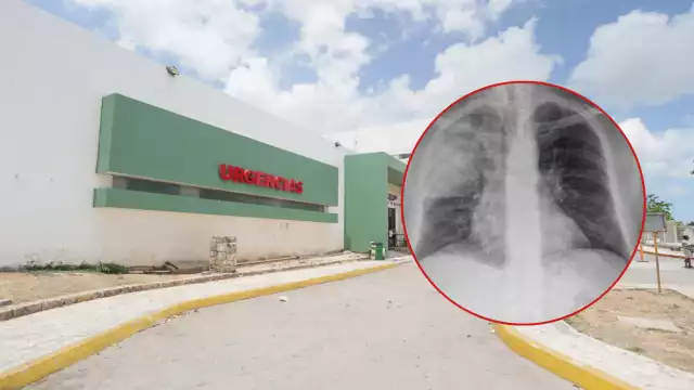 La lluvia, humedad y uso excesivo del aire acondicionado favorecen afecciones, según experto