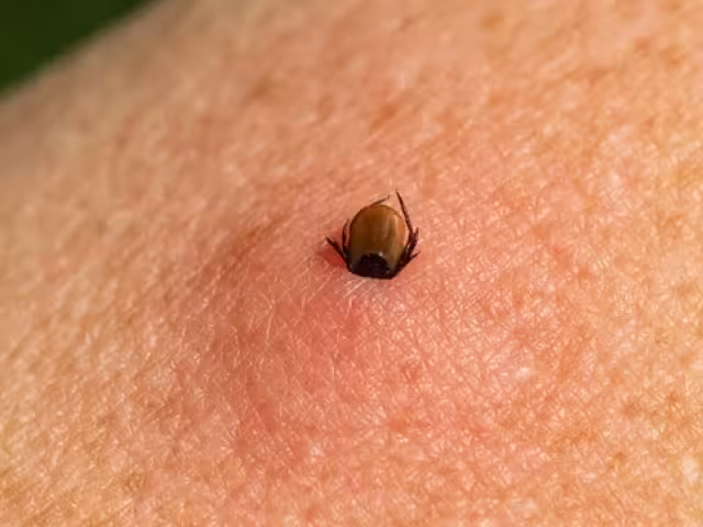 La Rickettsiosis es causada por un conjunto de bacterias que pueden generar diversos efectos, desde moderados a severos