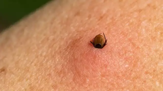 La Rickettsiosis es causada por un conjunto de bacterias que pueden generar diversos efectos, desde moderados a severos