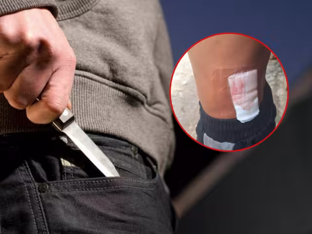 Efraín dijo que la empresa lo presionó para mentir por la lesión