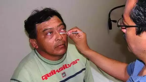 Síntomas y prevención: lo que debes saber sobre la conjuntivitis en temporada de calor Síntomas y prevención: lo que debes saber sobre la conjuntivitis en temporada de calor