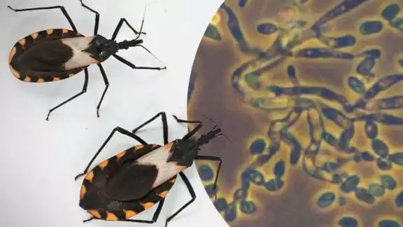 Mal de Chagas: cómo se transmite, cómo detectarlo y cómo prevenirlo Mal de Chagas: cómo se transmite, cómo detectarlo y cómo prevenirlo