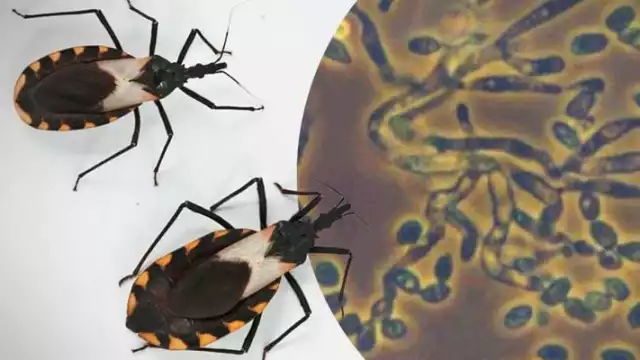 Mal de Chagas: cómo se transmite, cómo detectarlo y cómo prevenirlo