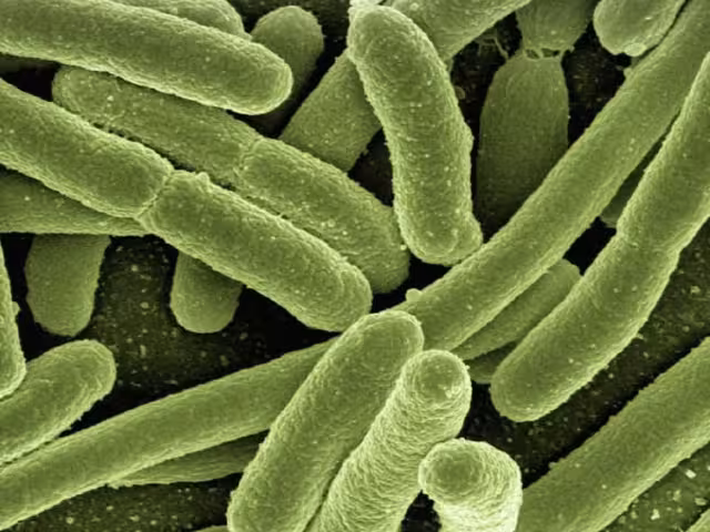 Bacteria Klebsiella Oxytoca: Confirman 8 niños muertos en el Estado de México