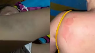 Hopelchén: Mujer golpeada por su esposo rompe el silencio y desmiente acusaciones de robo 