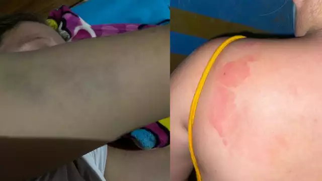 Mujer embarazada desmiente a su suegro en Hopelchén: acusa violencia familiar y no robo policial