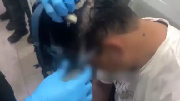 Hombre en Colombia esconde droga en peluca Hombre en Colombia esconde droga en peluca