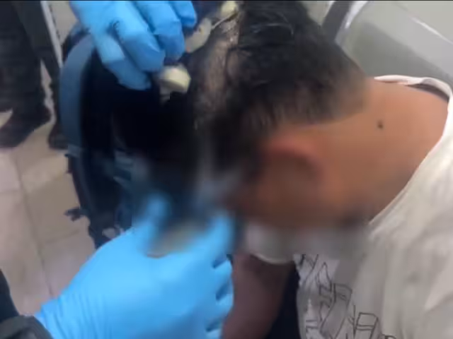Hombre en Colombia esconde droga en peluca