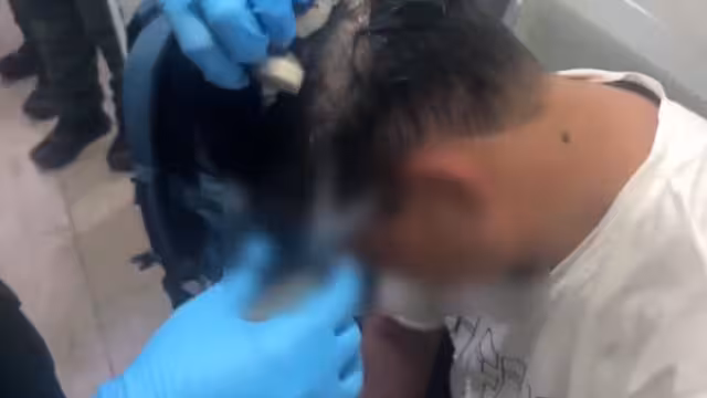 Hombre en Colombia esconde droga en peluca