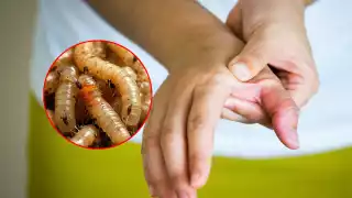 Gusano barrenador en humanos: Cómo afecta y cuál es la situación actual en Campeche 