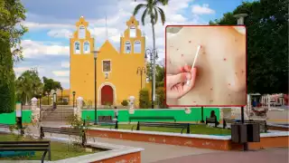 Hopelchén en cuarentena: Seis casos de sarampión encienden alarmas