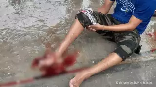 Joven termina con el pie destrozado  en accidente de moto en Escárcega