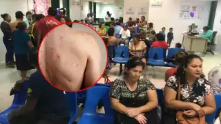 Campeche encabeza contagios de sarampión en la Península de Yucatán con 6 casos confirmados   