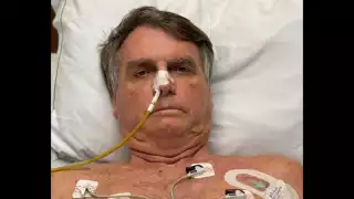 Estado de salud de Jair Bolsonaro se agrava tras cirugía intestinal al presentar presión alta y problemas hepáticos