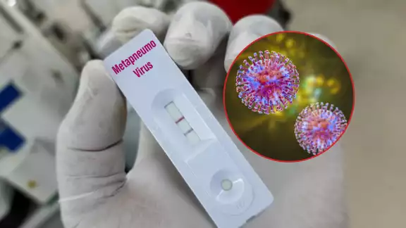 Confirmado el primer caso de Metapneumovirus humano en Puebla Confirmado el primer caso de Metapneumovirus humano en Puebla