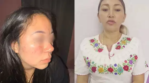 Destituyen a directora de Deportes en Candelaria por agresión a universitaria