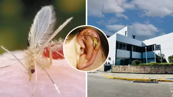 La Leishmaniasis tiene mayor incidencia en Candelaria, Calakmul y parte de Hopelchén por la vegetación; también es tratable, aunque las lesiones no cierran. La Leishmaniasis tiene mayor incidencia en Candelaria, Calakmul y parte de Hopelchén por la vegetación; también es tratable, aunque las lesiones no cierran.