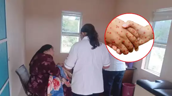 El sarampión llegó a Hopelchén tras un viaje a Chihuahua de una familia que contrajo el virus El sarampión llegó a Hopelchén tras un viaje a Chihuahua de una familia que contrajo el virus