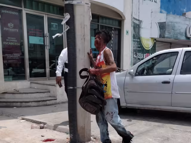 Con graves lesiones y quemaduras resulto un hombre conocido como El Canica