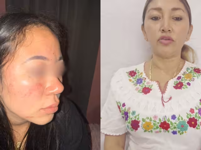 Destituyen a directora de Deportes en Candelaria por agresión a universitaria