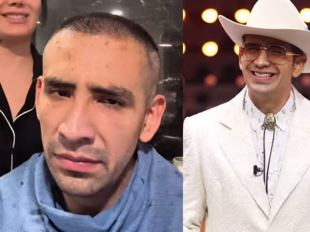 Apariencia de Capi Pérez causa preocupación entre sus fans