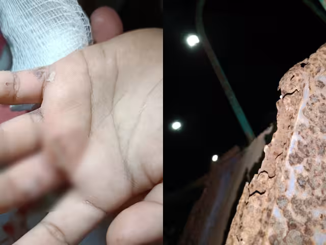 Vecinos de la zona señalan que el deterioro del parque es una situación que se ha prolongado durante años