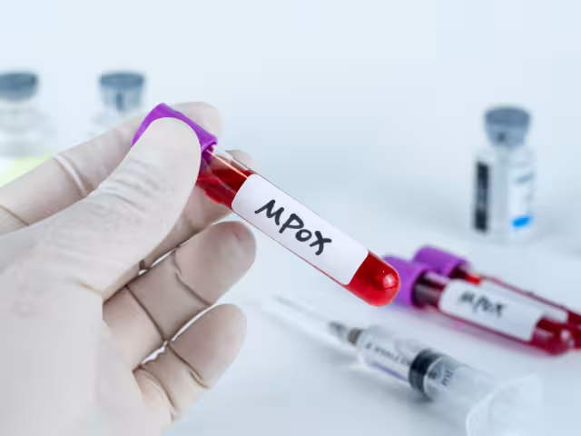 Dos casos sospechosos fueron descartados tras estudios del INDRE.