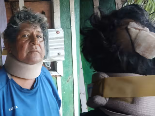 Raúl de la Rosa Méndez, de 63 años, sufrió un accidente en triciclo en la colonia Centro de Escárcega.