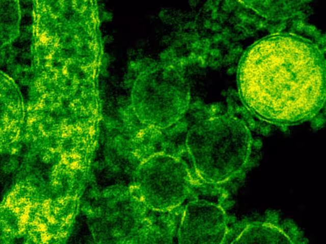 Estos son los síntomas principales de la bacteria Klebsiella Oxytoca
