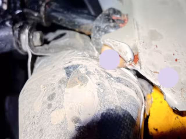 Menor de edad pierde dos dedos tras accidentes vehicular en Chetumal