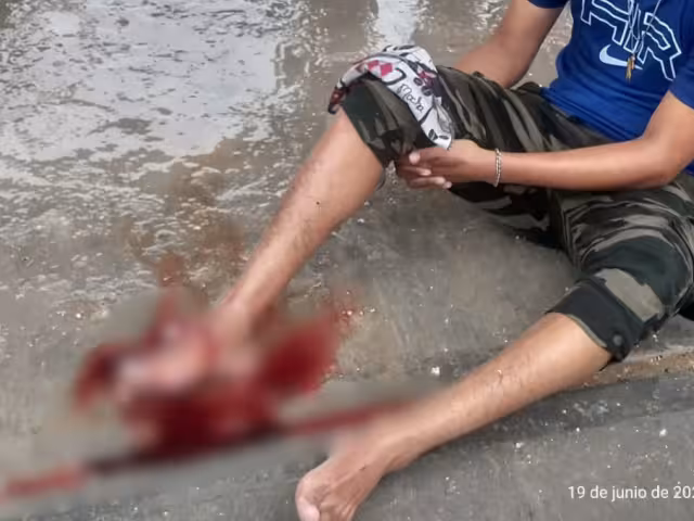 Un joven resultó gravemente herido en un accidente de motocicleta al no respetar una señal de alto