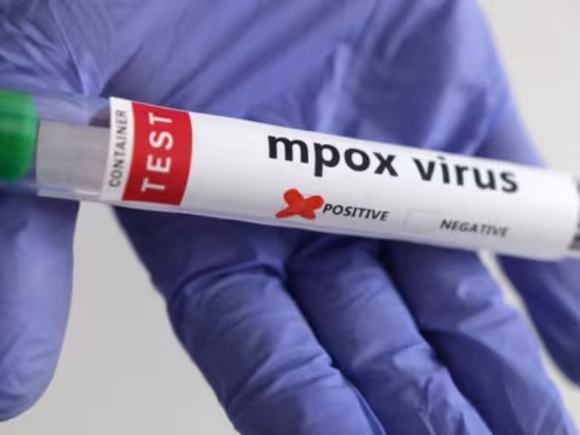 Campeche sin cerco sanitario, pero en guardia ante repunte de mpox vecino