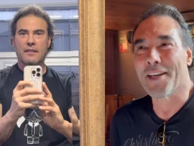 Así luce Eduardo Yáñez luego de su rejuvenecimiento facial