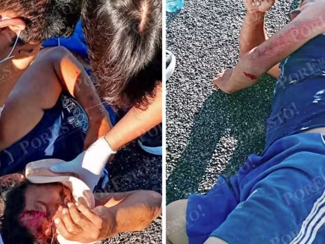 Sin testigos ni identidad: víctima de atropellamiento en Seybaplaya bajo investigación