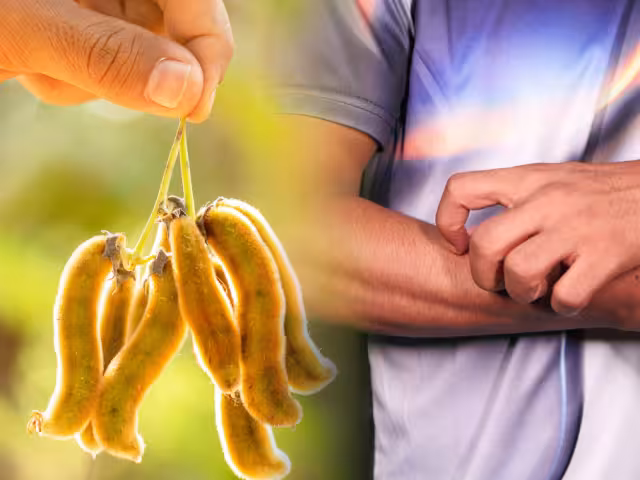 Mucuna pruriens, o pica pica, es una planta trepadora con pelillos urticantes