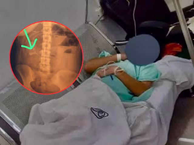 La afectada presentó fiebre, vómito y fuertes dolores días después de la operación en el Hospital General de Zona 18.