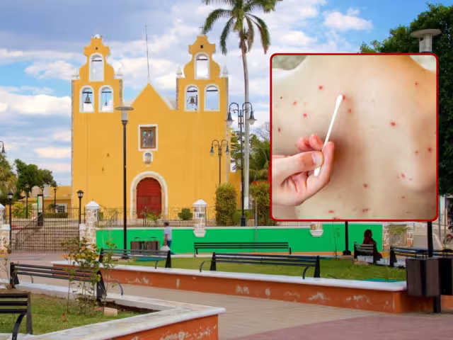 Refuerzan cerco epidemiológico tras la Feria de la Miel y el Maíz 2025.