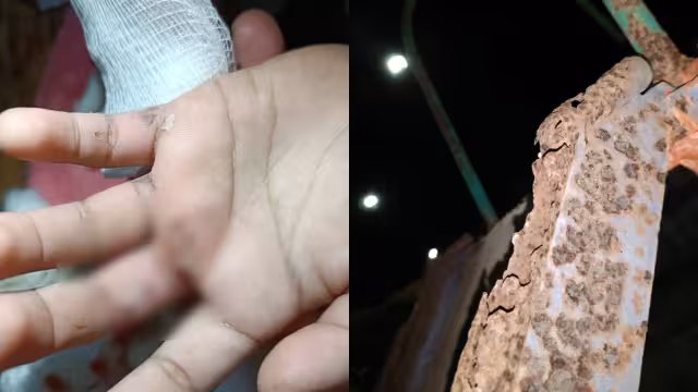 Vecinos de la zona señalan que el deterioro del parque es una situación que se ha prolongado durante años