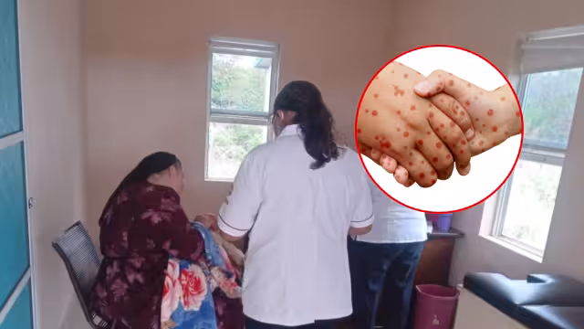 El sarampión llegó a Hopelchén tras un viaje a Chihuahua de una familia que contrajo el virus