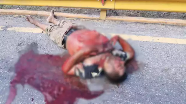 Mandadito terminó con las vísceras de fuera al impactarse en su moto